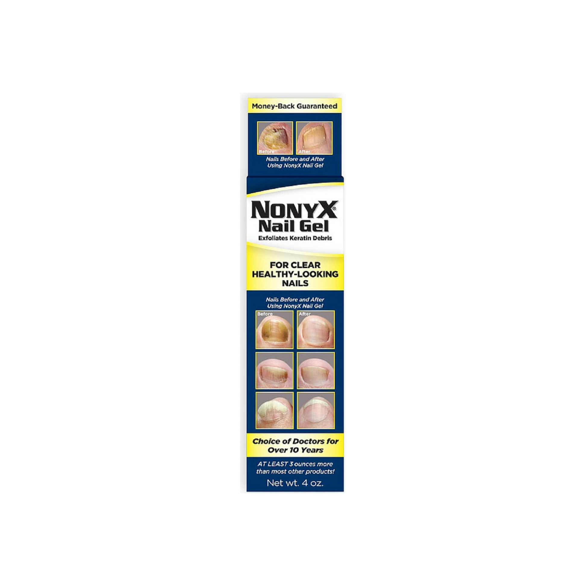 Nonyx Nail Gel 4 Oz